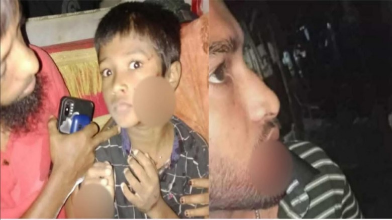 কুমিল্লা দেবিদ্বারে শিয়ালের কামড়ে শিশুসহ আহত ৭...