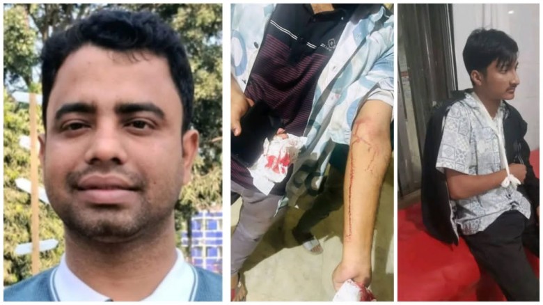কুমিল্লা বিশ্ববিদ্যালয় নিজ দলের কর্মীর নাক ফা"টি'...
