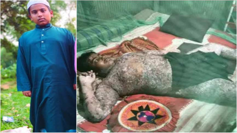 টাকার অভাবে চিকিৎসাহীনতায় সিয়ামের জীবন প