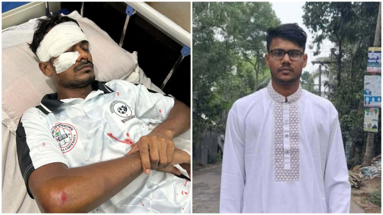 কুবিতে সহপাঠীকে লোহার শিকল দিয়ে মা'র'ধর, স্থায়ী ব'হি'ষ্কা'রের দাবি