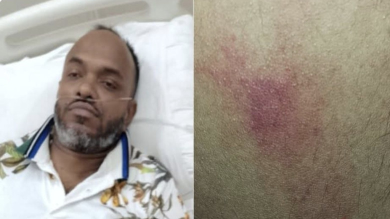 কুমিল্লায় সাংবাদিককে অপহরণের চেষ্টা, টাকা ও মোবাইল ছিনতাইয়ের অভিযোগ