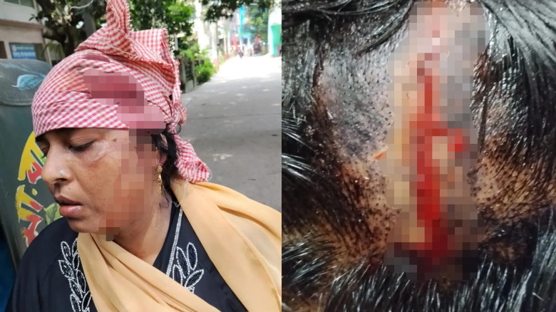 লালমাইয়ে প্রবাসীর স্ত্রীর ওপর হা'ম'লার অভিযোগ
